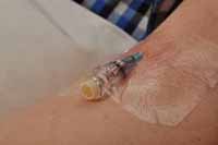 Peripheral Intravenous Device (PIVD) or IV cannula